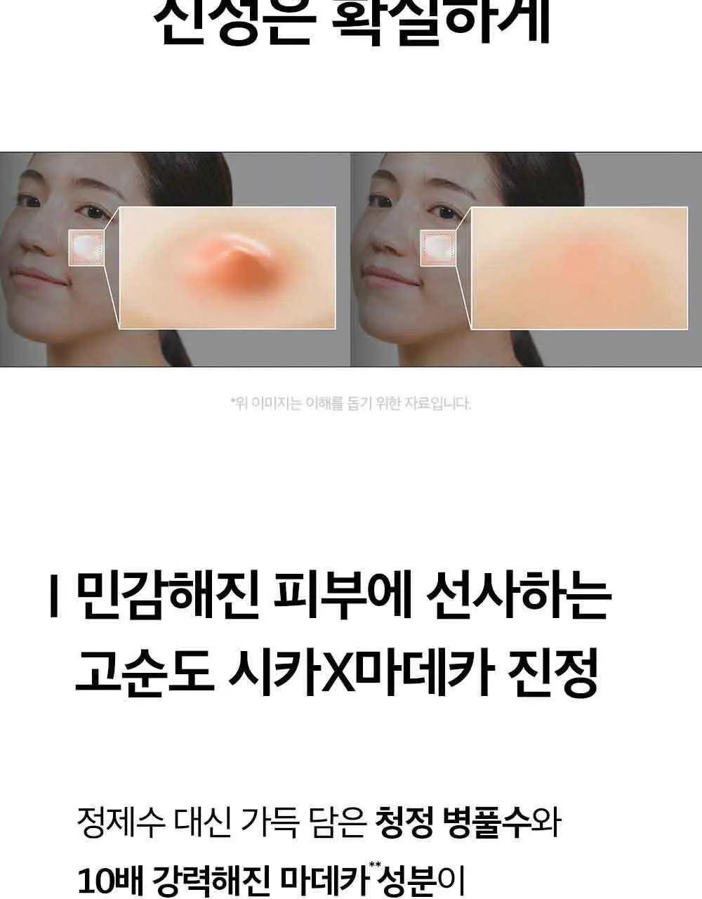 피부미 센텔루션 시카 크림 3X 100ml [지복합성] 상세페이지 15